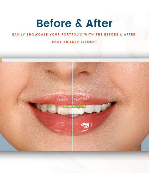 Clinio - Thème WordPress médical et dentaire avant et après